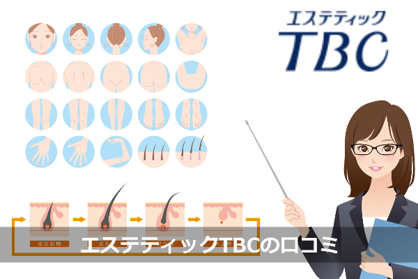 TBCの悪い口コミ・良い口コミ（アンケート結果を全公開）