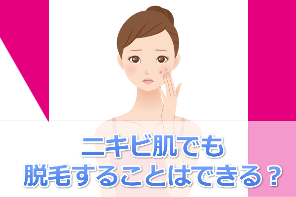 ニキビ肌でも脱毛サロンはOK？悪化したり脱毛効果なしってことは？
