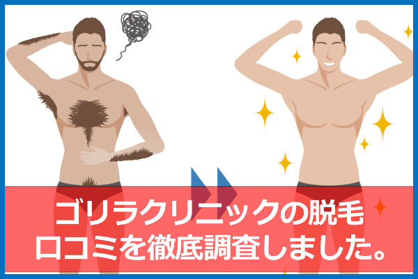 ゴリラクリニックの悪い口コミも公開（メリット・デメリット）