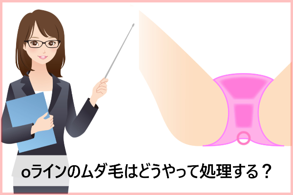 Oライン脱毛は自己処理危険！恥ずかしいけど脱毛サロンにいくべき3つの理由